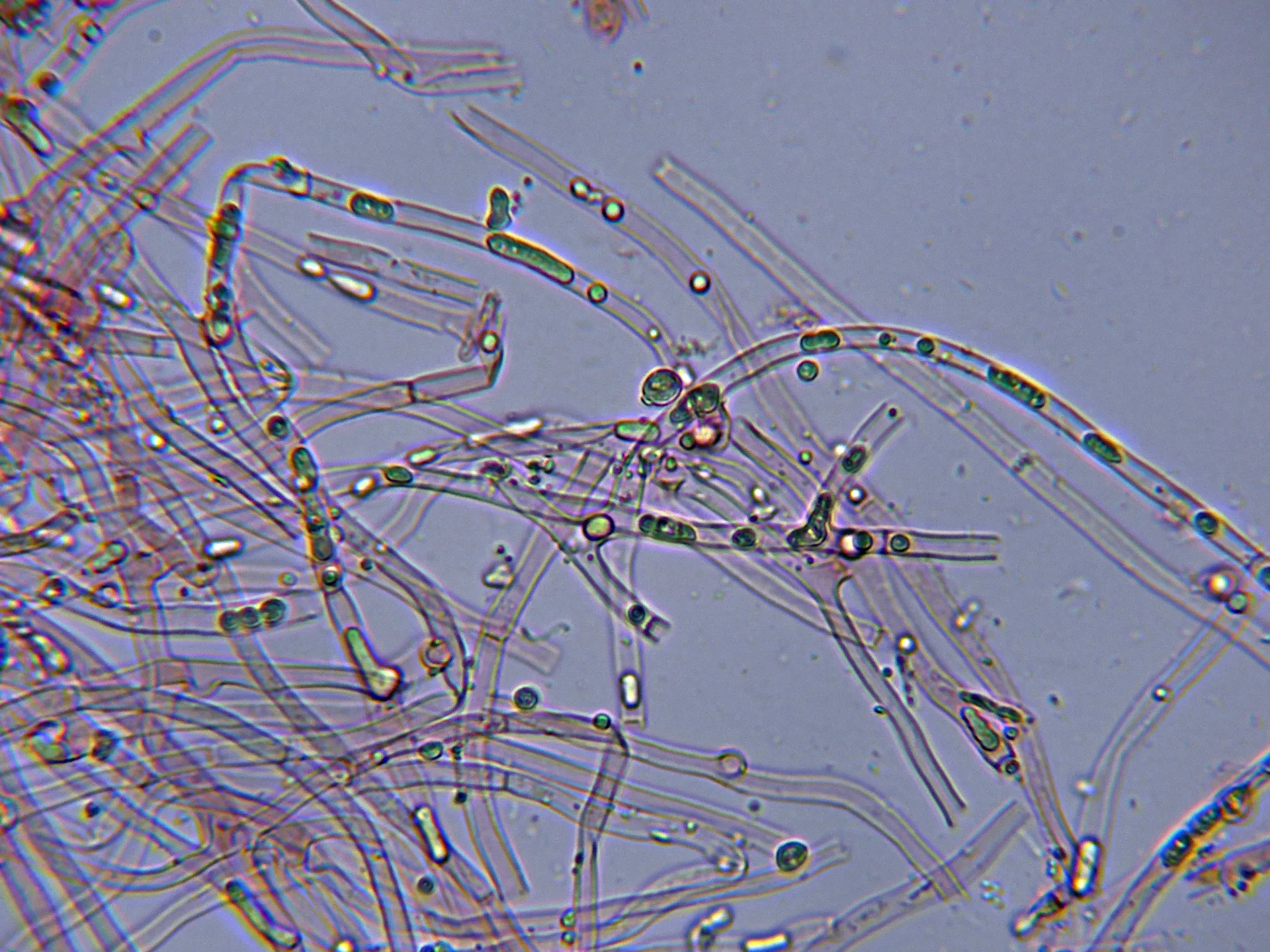 4 - Hifas con aceite-001